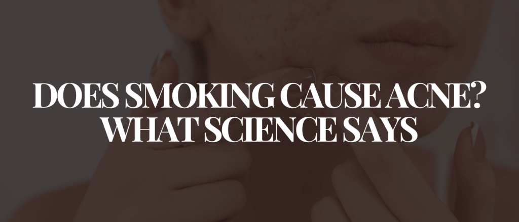 Does Smoking Cause Acne_ What Science Says